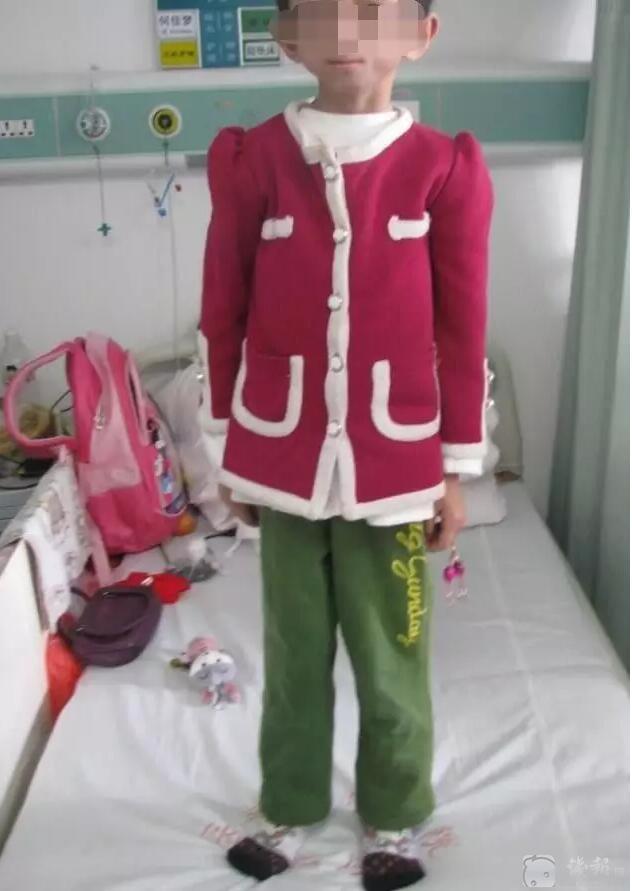12岁女孩老得像80岁阿婆,满脸皱纹,一碰就倒.