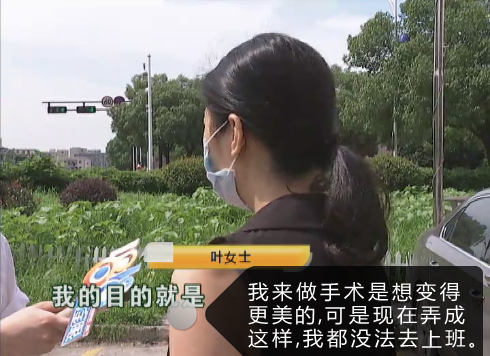 一女子到萧山一家整形医院做了脸部脂肪填充 