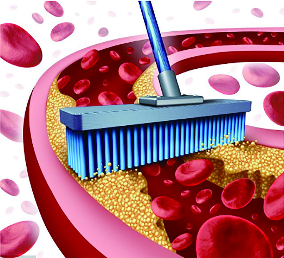 "血管垃圾", 一个认知的误区!