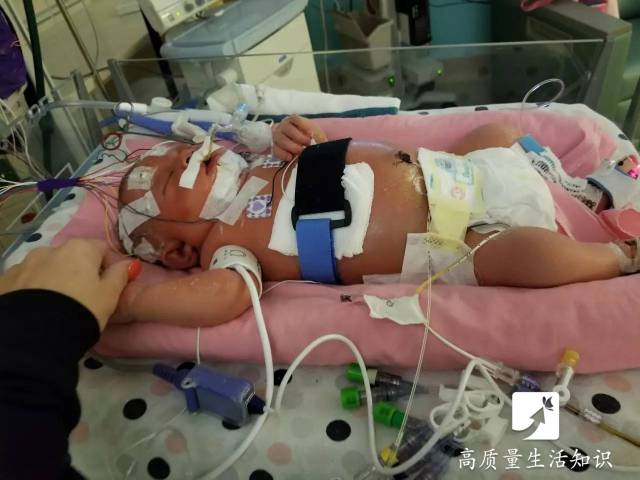 告诉身边人不要随便亲孩子, 否则后悔终生