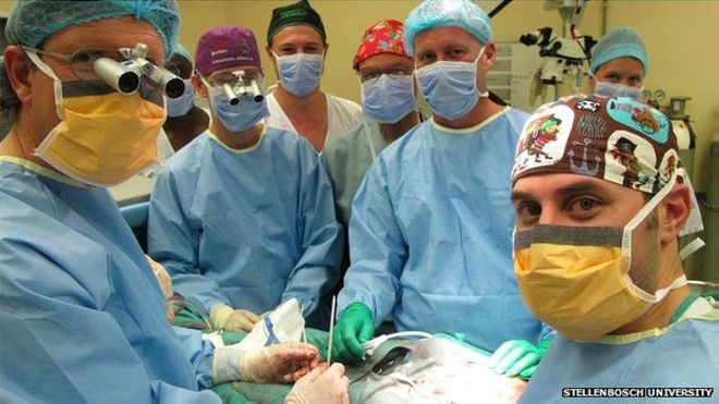 男性割礼过程 手术图片