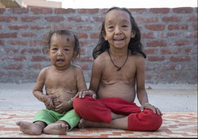 世界罕见病相关电影 d422172a8281342dc7596fcfb25c6e14.png