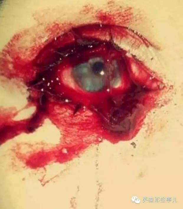 像下面这样的场景是妹子的日常,真的不是特效.眼睛,鼻子,耳朵,指甲.